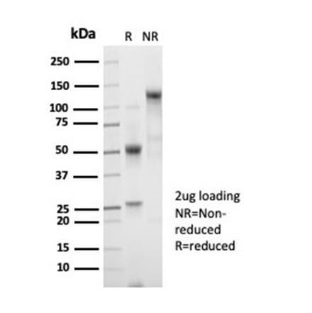 SDS-PAGE - Anti-beta 2 Microglobulin Antibody [B2M/7013R] - BSA and Azide free (A278640) - Antibodies.com