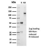 SDS-PAGE - Anti-CD45RA Antibody [PTPRC/7018R] - BSA and Azide free (A278641) - Antibodies.com