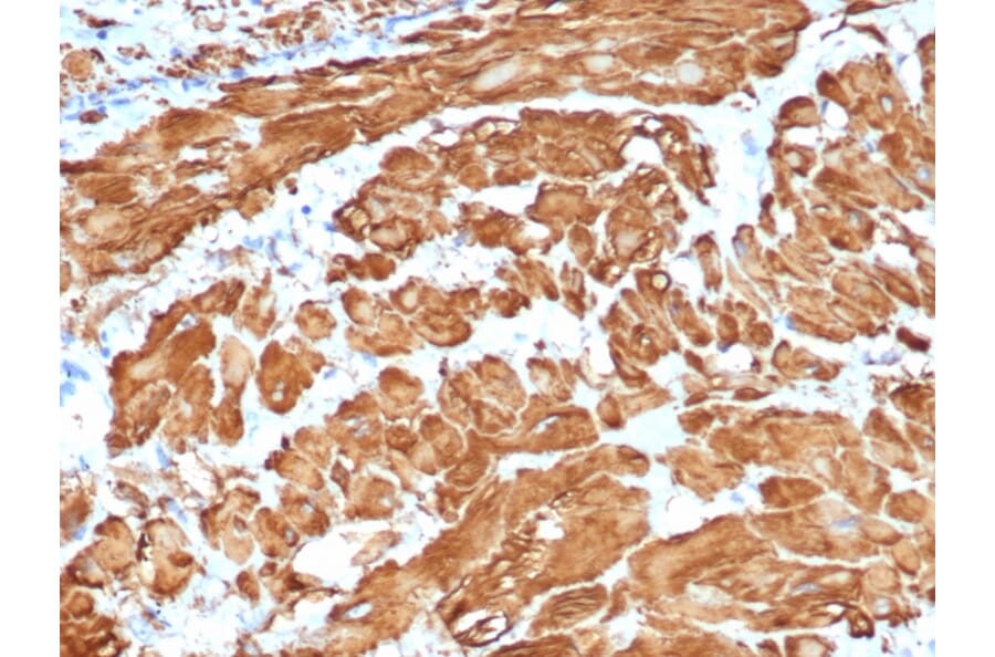Immunohistochemistry - Anti-alpha Smooth Muscle Actin Antibody [ACTA2/1614R] - BSA and Azide free (A278643) - Antibodies.com