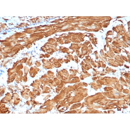 Immunohistochemistry - Anti-alpha Smooth Muscle Actin Antibody [ACTA2/1614R] - BSA and Azide free (A278643) - Antibodies.com