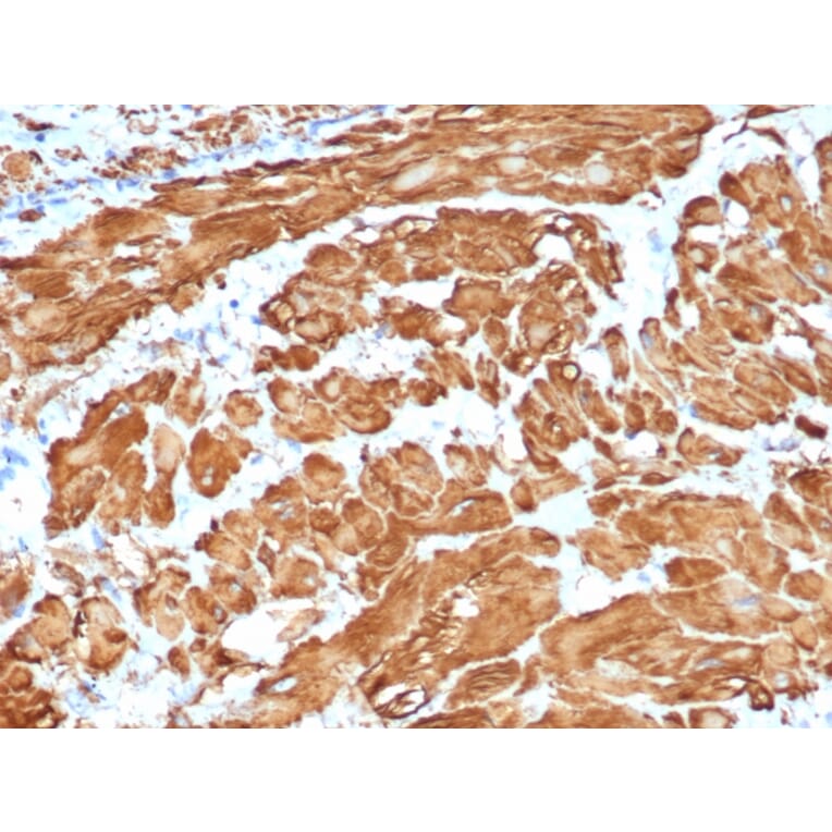 Immunohistochemistry - Anti-alpha Smooth Muscle Actin Antibody [ACTA2/1614R] - BSA and Azide free (A278643) - Antibodies.com