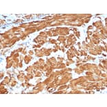 Immunohistochemistry - Anti-alpha Smooth Muscle Actin Antibody [ACTA2/1614R] - BSA and Azide free (A278643) - Antibodies.com