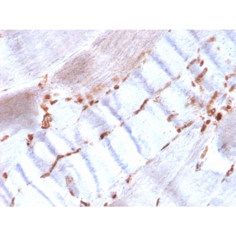 Immunohistochemistry - Anti-alpha Smooth Muscle Actin Antibody [ACTA2/1614R] - BSA and Azide free (A278643) - Antibodies.com