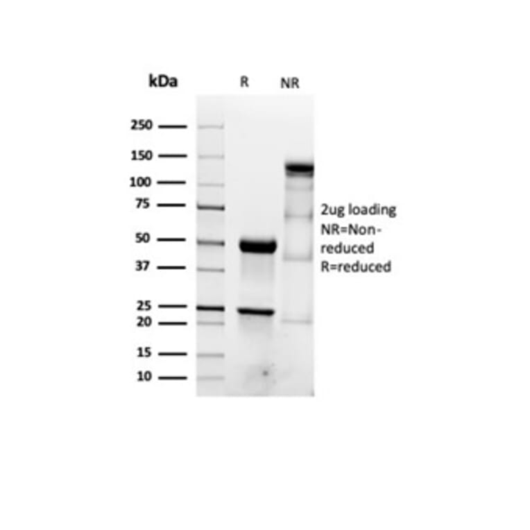 SDS-PAGE - Anti-alpha Smooth Muscle Actin Antibody [ACTA2/1614R] - BSA and Azide free (A278643) - Antibodies.com