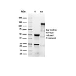 SDS-PAGE - Anti-alpha Smooth Muscle Actin Antibody [ACTA2/1614R] - BSA and Azide free (A278643) - Antibodies.com