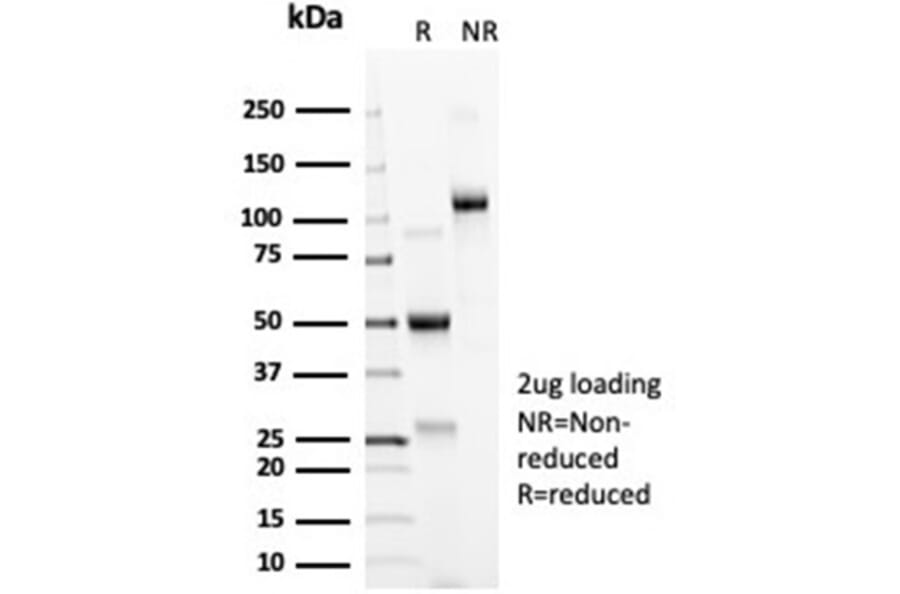 SDS-PAGE - Anti-ACE2 Antibody [ACE2/6788R] - BSA and Azide free (A278644) - Antibodies.com
