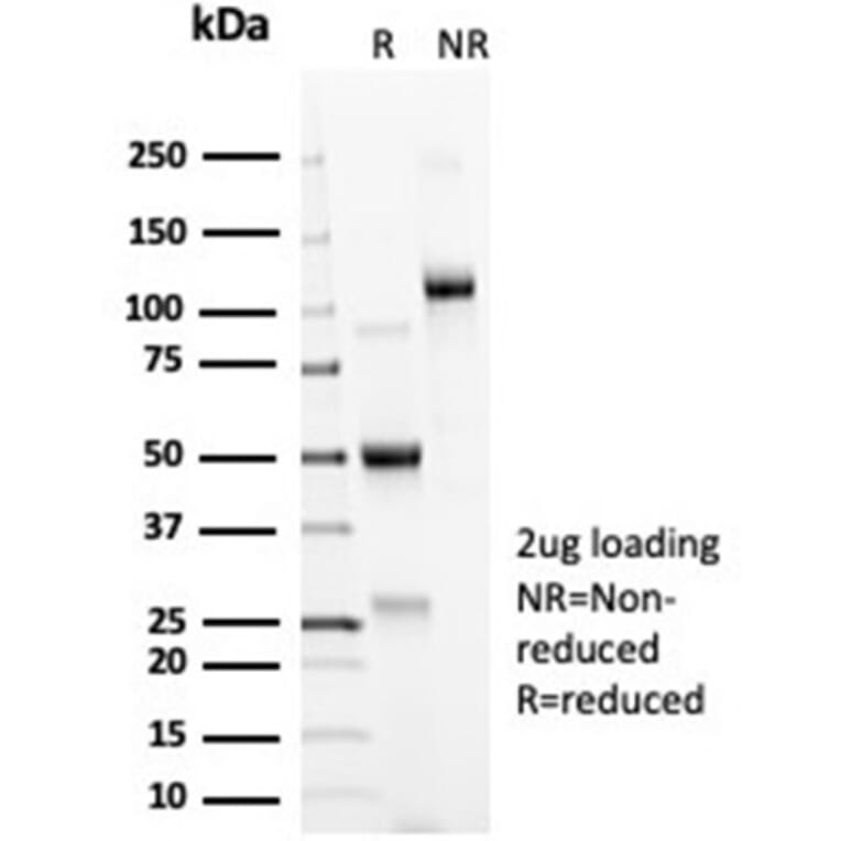 SDS-PAGE - Anti-ACE2 Antibody [ACE2/6788R] - BSA and Azide free (A278644) - Antibodies.com