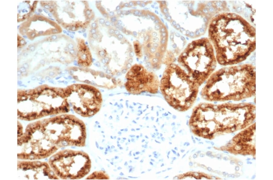 Immunohistochemistry - Anti-RBP4 Antibody [RBP4/7045R] - BSA and Azide free (A278645) - Antibodies.com