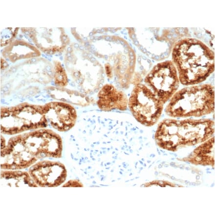 Immunohistochemistry - Anti-RBP4 Antibody [RBP4/7045R] - BSA and Azide free (A278645) - Antibodies.com