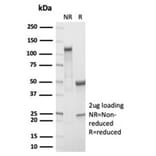 SDS-PAGE - Anti-RBP4 Antibody [RBP4/7045R] - BSA and Azide free (A278645) - Antibodies.com