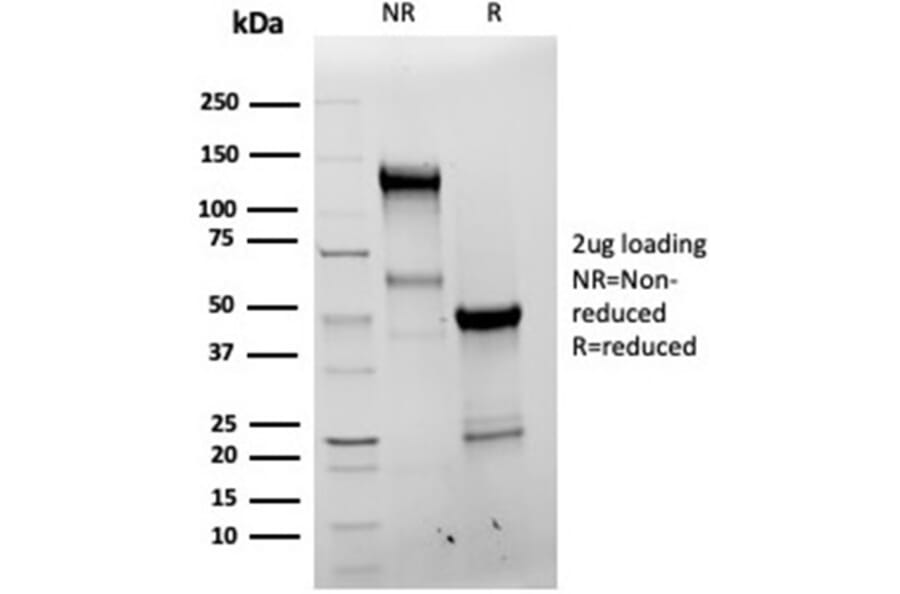 SDS-PAGE - Anti-Bcl-X Antibody [BCL2L1/4509R] - BSA and Azide free (A278646) - Antibodies.com