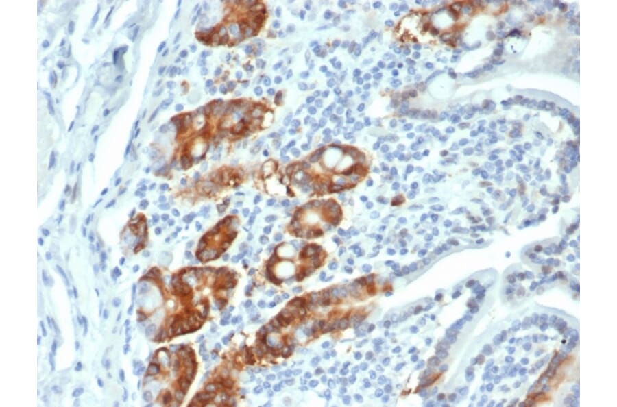Immunohistochemistry - Anti-RRM1 Antibody [RRM1/4372R] - BSA and Azide free (A278647) - Antibodies.com