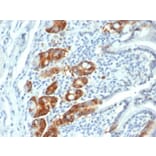 Immunohistochemistry - Anti-RRM1 Antibody [RRM1/4372R] - BSA and Azide free (A278647) - Antibodies.com
