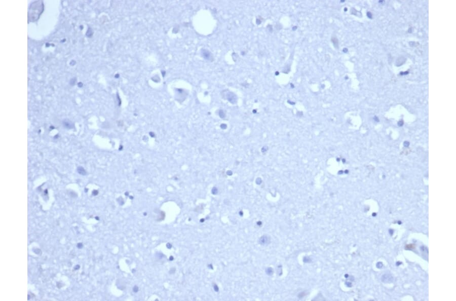Immunohistochemistry - Anti-RRM1 Antibody [RRM1/4372R] - BSA and Azide free (A278647) - Antibodies.com