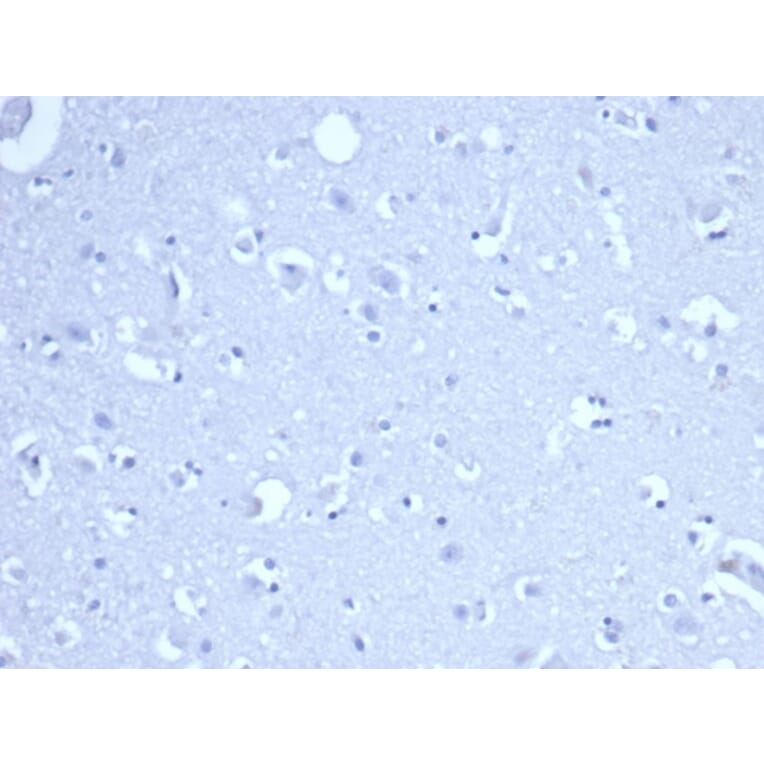 Immunohistochemistry - Anti-RRM1 Antibody [RRM1/4372R] - BSA and Azide free (A278647) - Antibodies.com