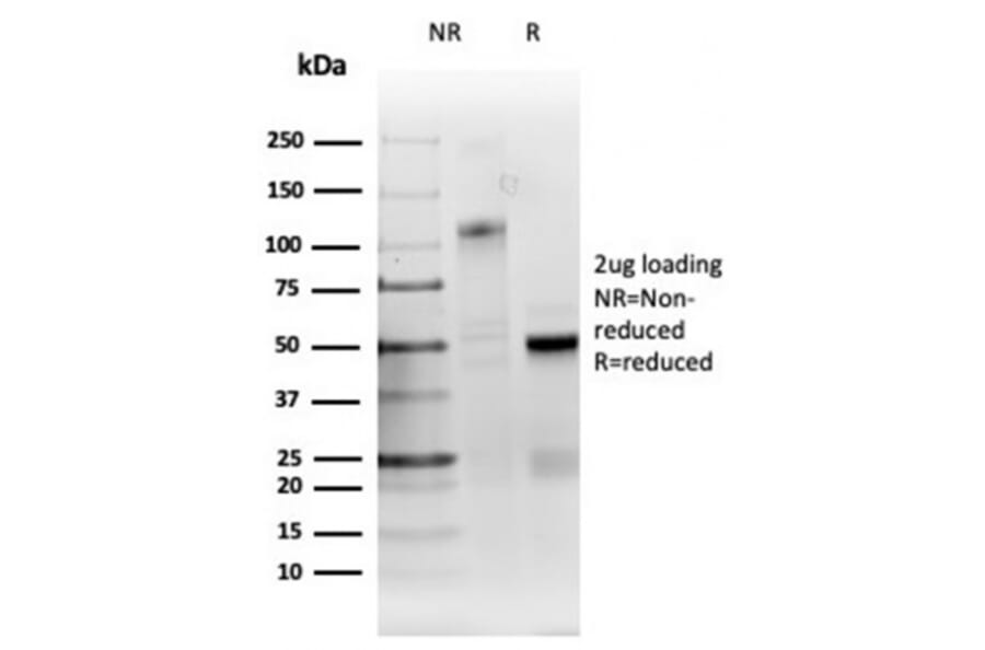 SDS-PAGE - Anti-RRM1 Antibody [RRM1/4372R] - BSA and Azide free (A278647) - Antibodies.com