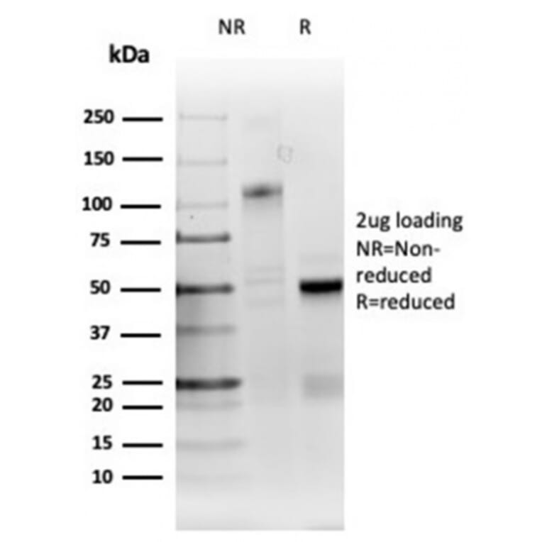 SDS-PAGE - Anti-RRM1 Antibody [RRM1/4372R] - BSA and Azide free (A278647) - Antibodies.com