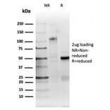 SDS-PAGE - Anti-RRM1 Antibody [RRM1/4372R] - BSA and Azide free (A278647) - Antibodies.com