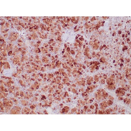 Immunohistochemistry - Anti-SDHB Antibody [SDHB/6697R] - BSA and Azide free (A278648) - Antibodies.com