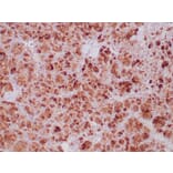 Immunohistochemistry - Anti-SDHB Antibody [SDHB/6697R] - BSA and Azide free (A278648) - Antibodies.com