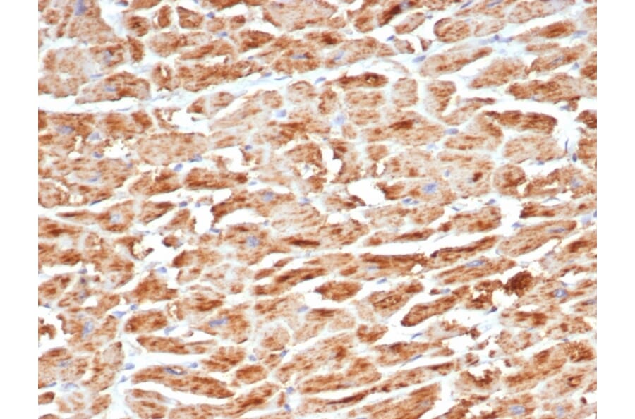 Immunohistochemistry - Anti-SDHB Antibody [SDHB/6697R] - BSA and Azide free (A278648) - Antibodies.com