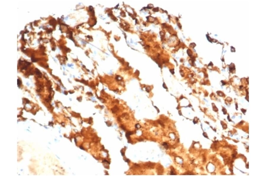Immunohistochemistry - Anti-Surfactant Protein D Antibody [SFTPD/7084R] - BSA and Azide free (A278649) - Antibodies.com