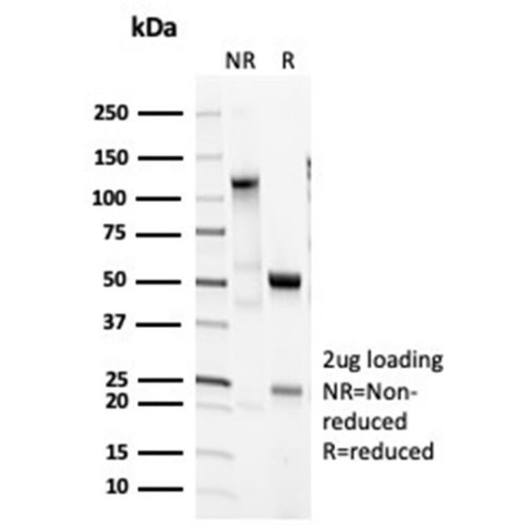 SDS-PAGE - Anti-Surfactant Protein D Antibody [SFTPD/7085R] - BSA and Azide free (A278650) - Antibodies.com