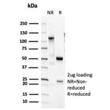 SDS-PAGE - Anti-Surfactant Protein D Antibody [SFTPD/7085R] - BSA and Azide free (A278650) - Antibodies.com