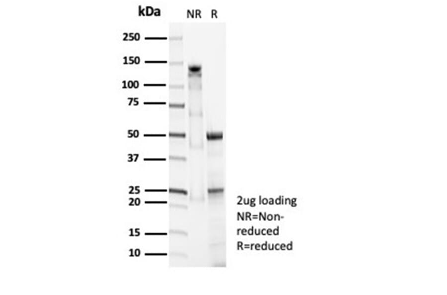 SDS-PAGE - Anti-Surfactant Protein D Antibody [SFTPD/7086R] - BSA and Azide free (A278651) - Antibodies.com