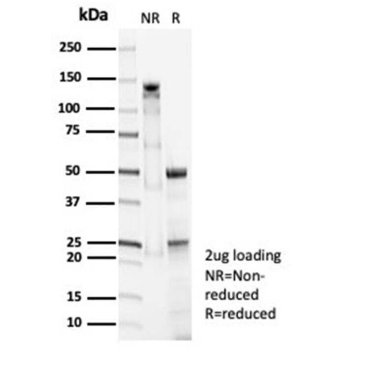 SDS-PAGE - Anti-Surfactant Protein D Antibody [SFTPD/7086R] - BSA and Azide free (A278651) - Antibodies.com