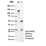 SDS-PAGE - Anti-Surfactant Protein D Antibody [SFTPD/7086R] - BSA and Azide free (A278651) - Antibodies.com
