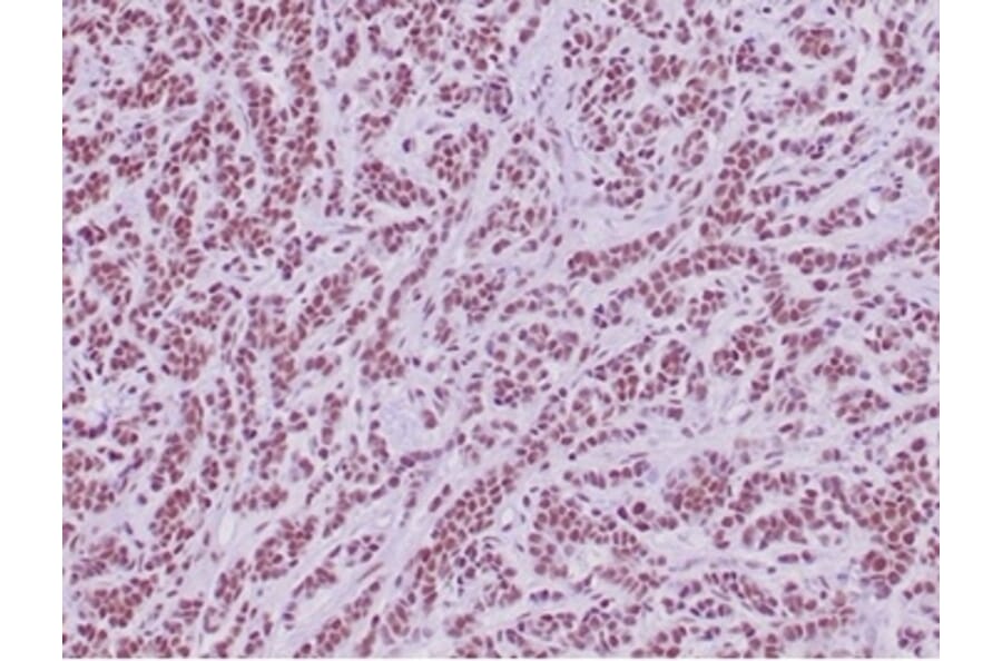 Immunohistochemistry - Anti-SNF5 Antibody [SMARCB1/4587R] - BSA and Azide free (A278652) - Antibodies.com