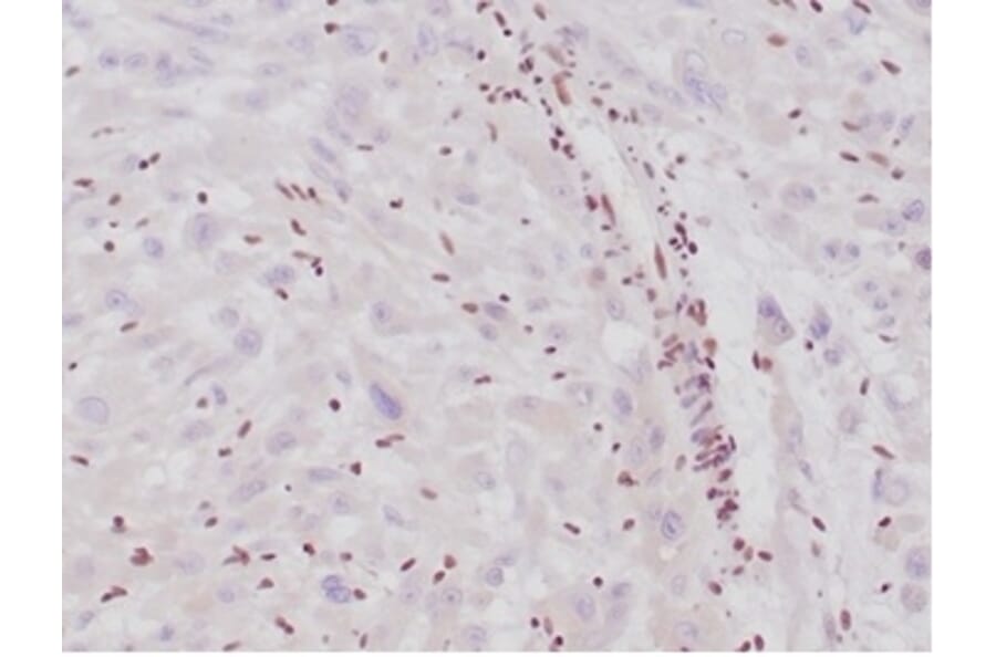 Immunohistochemistry - Anti-SNF5 Antibody [SMARCB1/4587R] - BSA and Azide free (A278652) - Antibodies.com