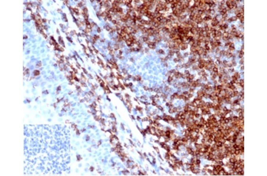 Immunohistochemistry - Anti-CD43 Antibody [SPN/6562R] - BSA and Azide free (A278654) - Antibodies.com