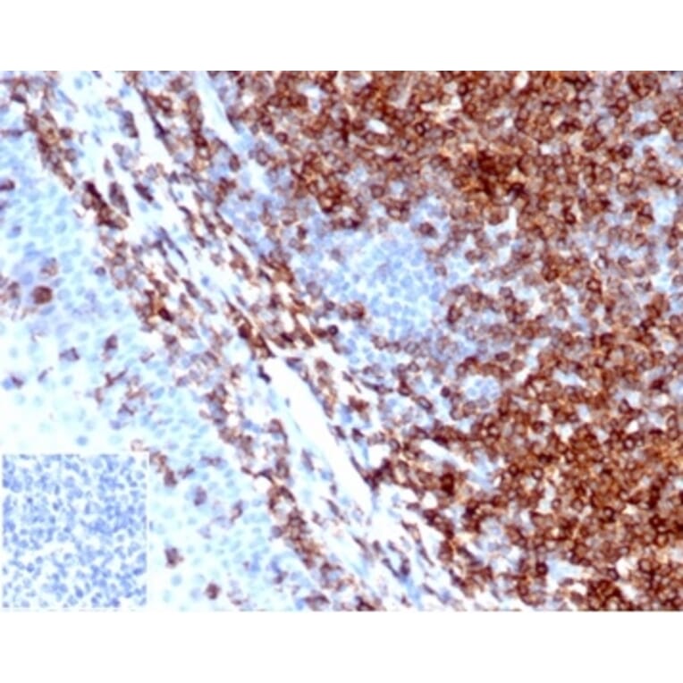 Immunohistochemistry - Anti-CD43 Antibody [SPN/6562R] - BSA and Azide free (A278654) - Antibodies.com