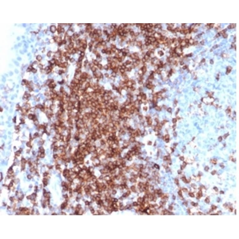 Immunohistochemistry - Anti-CD43 Antibody [SPN/6562R] - BSA and Azide free (A278654) - Antibodies.com