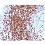 Immunohistochemistry - Anti-CD43 Antibody [SPN/6562R] - BSA and Azide free (A278654) - Antibodies.com