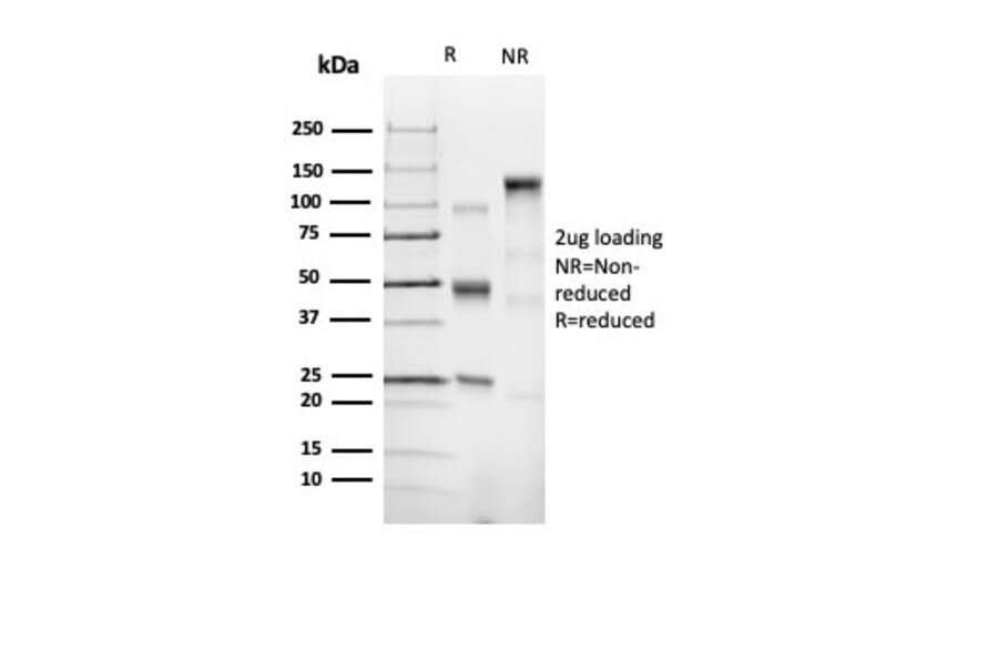 SDS-PAGE - Anti-CD43 Antibody [SPN/6562R] - BSA and Azide free (A278654) - Antibodies.com