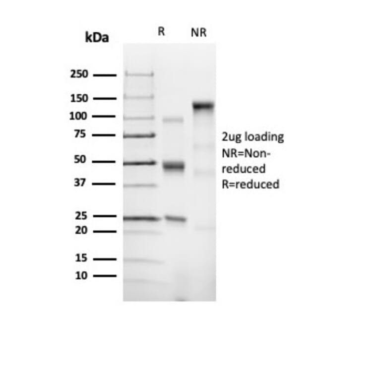 SDS-PAGE - Anti-CD43 Antibody [SPN/6562R] - BSA and Azide free (A278654) - Antibodies.com