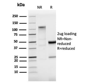 SDS-PAGE - Anti-StAR Antibody [STAR/3915R] - BSA and Azide free (A278655) - Antibodies.com