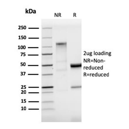 SDS-PAGE - Anti-StAR Antibody [STAR/3915R] - BSA and Azide free (A278655) - Antibodies.com