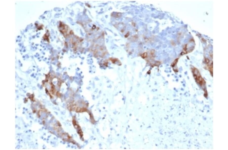 Immunohistochemistry - Anti-Transglutaminase II Antibody [TGM2/6943R] - BSA and Azide free (A278658) - Antibodies.com