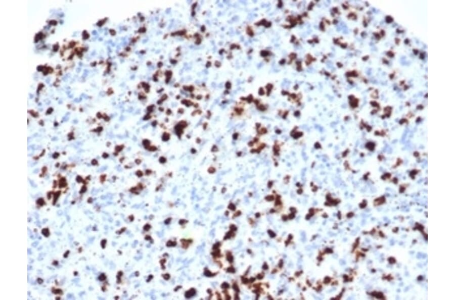 Immunohistochemistry - Anti-TIA1 Antibody [TIA1/1352R] - BSA and Azide free (A278659) - Antibodies.com