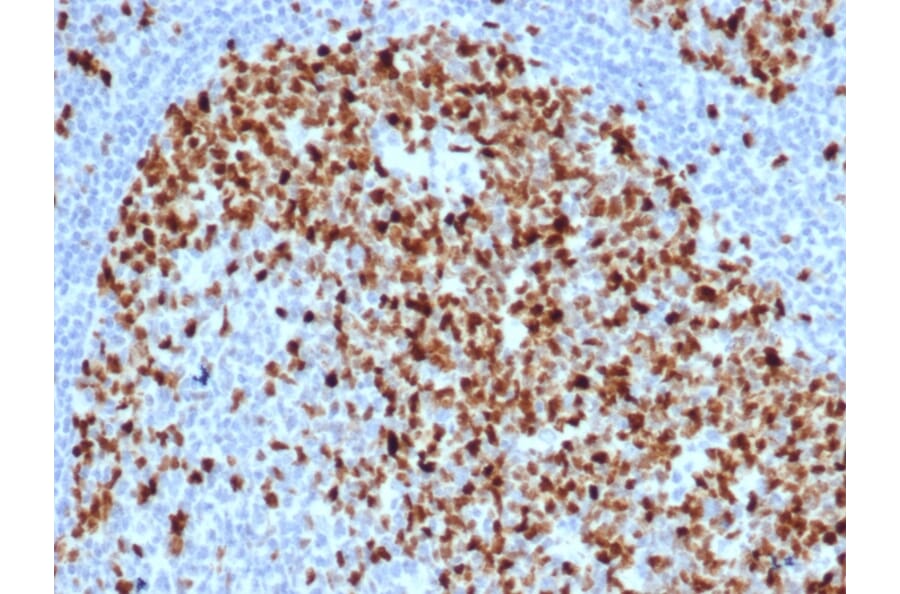 Immunohistochemistry - Anti-Topoisomerase II alpha Antibody [TOP2A/6570R] - BSA and Azide free (A278660) - Antibodies.com