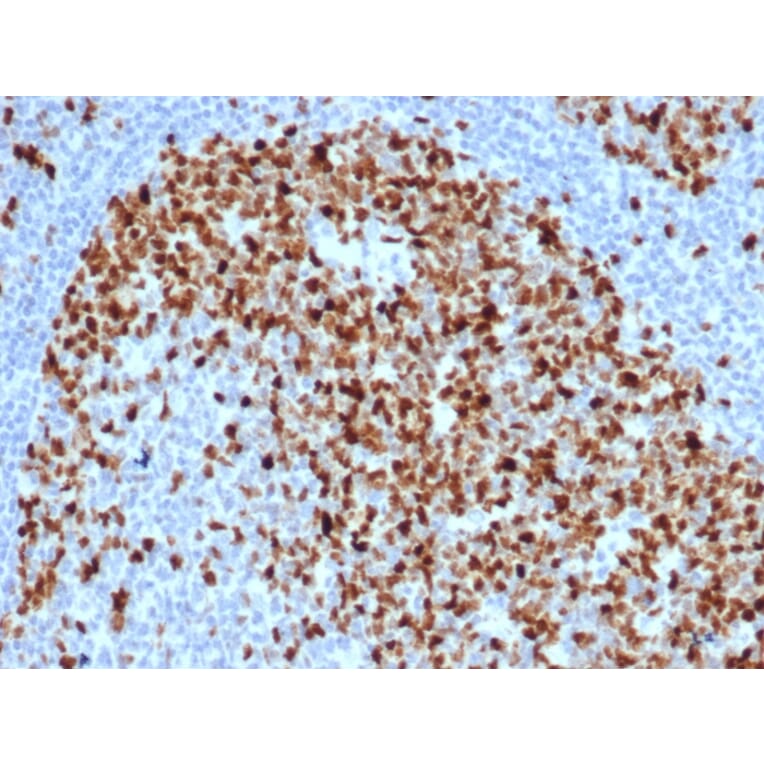 Immunohistochemistry - Anti-Topoisomerase II alpha Antibody [TOP2A/6570R] - BSA and Azide free (A278660) - Antibodies.com