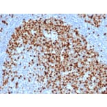 Immunohistochemistry - Anti-Topoisomerase II alpha Antibody [TOP2A/6570R] - BSA and Azide free (A278660) - Antibodies.com