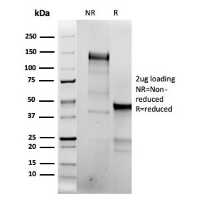 SDS-PAGE - Anti-Topoisomerase II alpha Antibody [TOP2A/6570R] - BSA and Azide free (A278660) - Antibodies.com