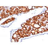 Immunohistochemistry - Anti-Thyroid Peroxidase Antibody [TPO/6417R] - BSA and Azide free (A278662) - Antibodies.com