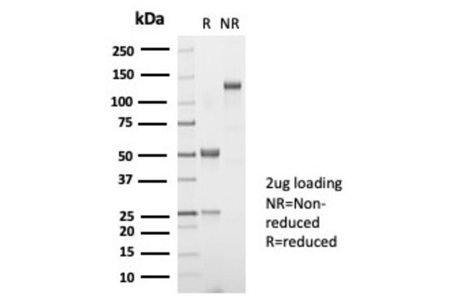 SDS-PAGE - Anti-TSH beta Antibody [TSHb/7001R] - BSA and Azide free (A278663) - Antibodies.com