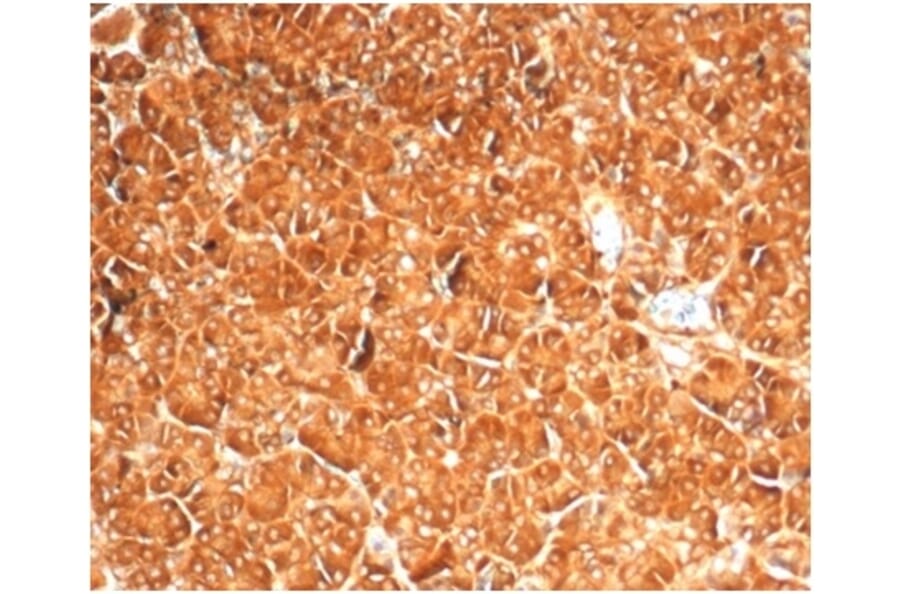 Immunohistochemistry - Anti-Vinculin Antibody [VCL/7091R] - BSA and Azide free (A278664) - Antibodies.com